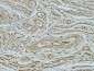 Bcl-2 Monoclonal Antibody(6B5)